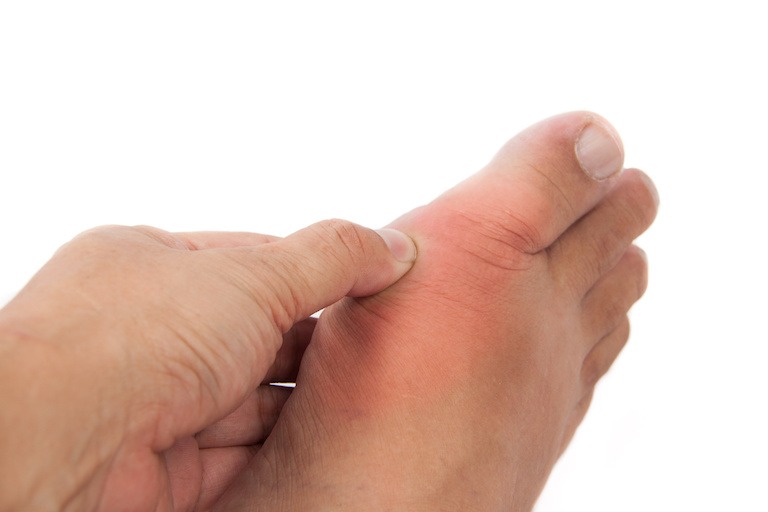 joint pain - gout