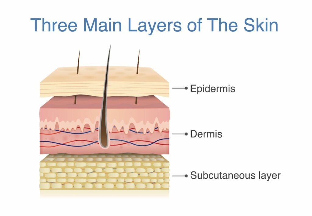 Cellulitis Mydr Com Au